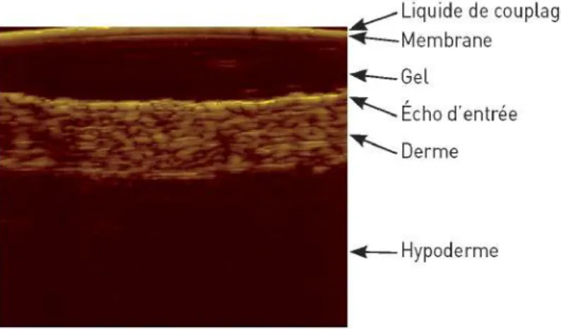 Figure 1.9: Image échographique de la peau avec une sonde de 20 MHz - Mode B [Naouri, 2008] .