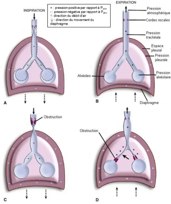 Figure 6 : Les effets d’une obstruction intrathoracique et extrathoracique sur la  physiologie respiratoire pulmonaire, figure adaptée de Litman et al., 2015 