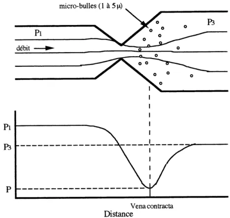 Figure 1.2 Ecoulement 2-phases: fluide non-homogene [Pandit et al, 1996]