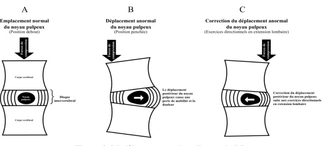 Figure 3. Modèle conceptuel expliquant la DP 