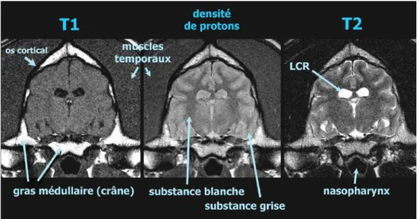 Figure 73 : Illustration des apparences de l’image selon le type de séquences (35) 