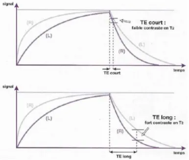 Figure 43 : Influence du TE sur la pondération en T2 d’une séquence (25) 