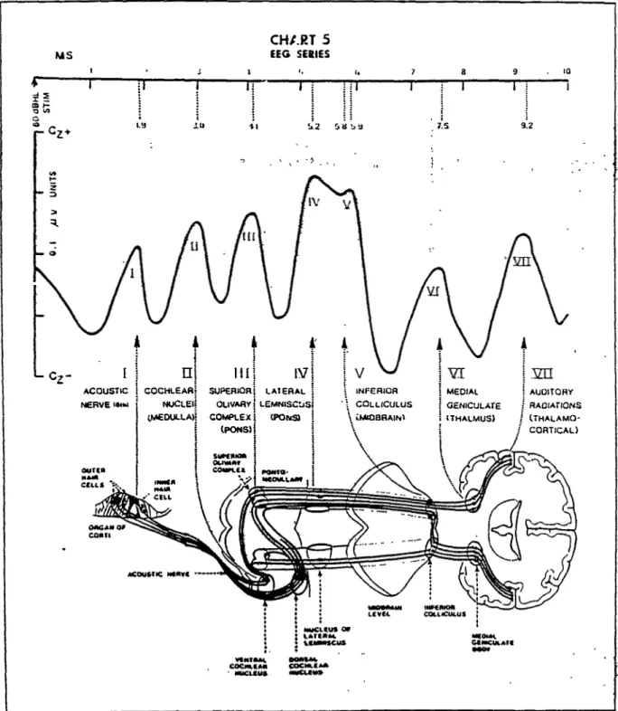 Fig. 7. Tracé des ondes tronculaires et les structures anatomiques du système auditif associées.