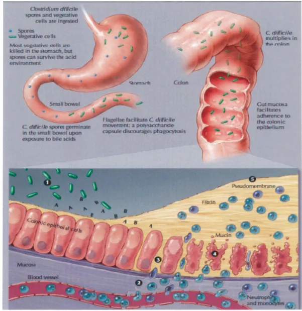 Figure 2: Pathogénèse des infections à Clostridium difficile.  La pathogénèse est expliquée en détail dans le texte