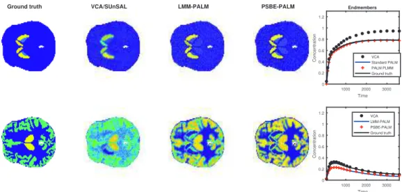 Fig. 2. Abundance maps (left) and corresponding TACs (right) associated with the SBR (top) and gray matter (bottom).