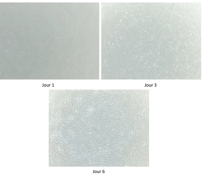 Figure 3 : Microphotographies d’ASCs dérivées de tissu adipeux sous cutané  de passage 1 à différents  jours de culture (ensemencées à 2000 cellules/cm²) 