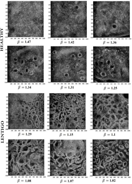 Fig. 2. Typical images at the DEJ from six healthy (left to right and top to bottom #1, #5, #4,