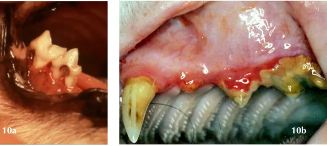 Figure  10a  et  10b:  Exemple  de  lésions  de  résorption  odontoclastique  et  comblement  typique  par  un  tissu  d’origine  gingivale  (Crédit  Photo :  10a  -  Dr  R