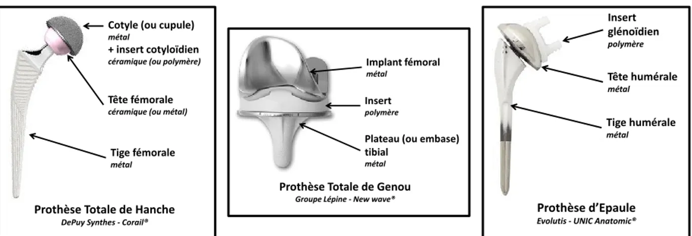 Figure 8. Exemples de prothèses orthopédiques de hanche, de genou et d’épaule 