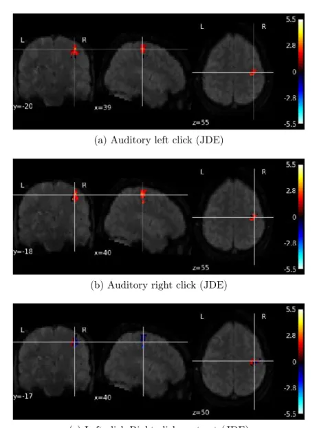 Figure 4.14: NRL estimates for the auditory left and right click experimental conditions and their computed contrast (left click-right click) using the JDE model.