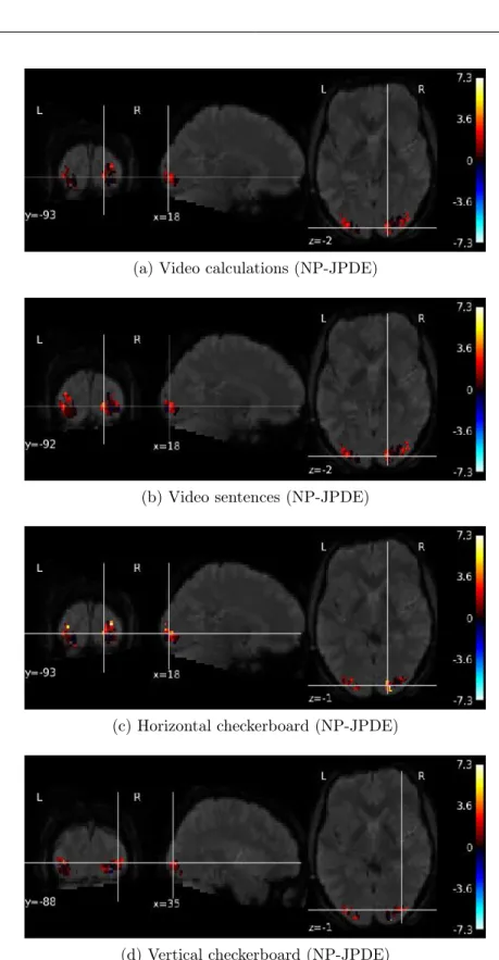 Figure 4.19: NRL estimates for the video calculations, video sentences horizontal and vertical checkerboard experimental conditions using NP-JPDE model.