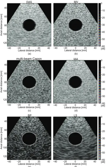 Fig. 4. Lateral profiles at 65-mm depth of the point reflectors represented in Fig. 3.