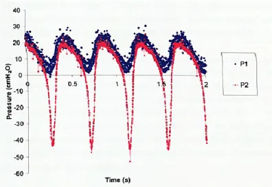 Figure 2.20 : Signaux de pression en amont 