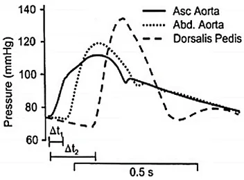 Figure 2.30 : Onde de pression relevée à plusieurs endroits dans le réseau artériel [38]  Cette méthode permet d’identifier la vitesse apparente