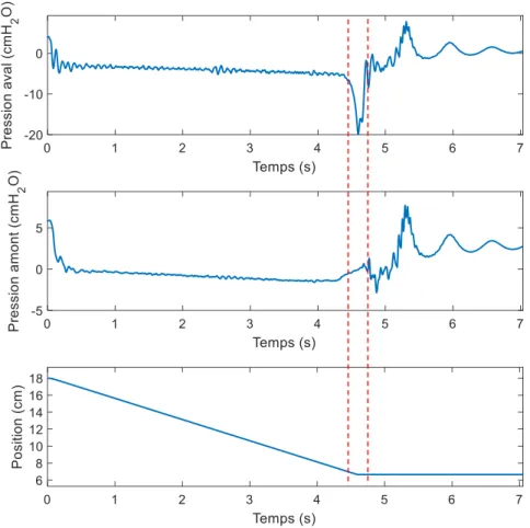 Figure 3.5 : Signaux de pression et de la position de piston relevés lors du retrait du liquide à un  débit de 40 ml/s 