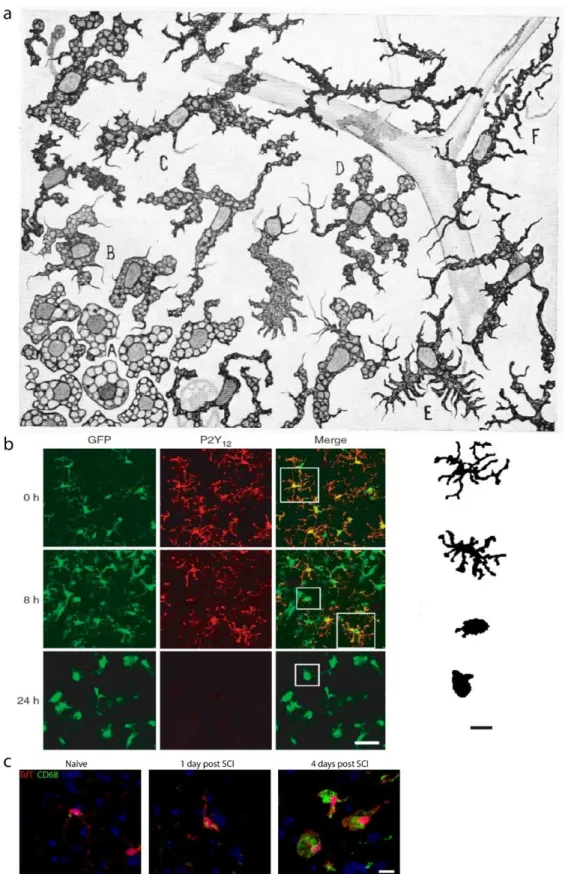 Figure 1.4. The different morphologies of microglia in the normal and pathological CNS