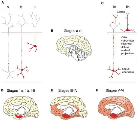 Figure  4 :  Progression  de  la  pathologie  tau  selon  les  travaux  de  Braak.  Les  pré- pré-enchevêtrements de neurofibrilles s’accumulent d’abord dans la partie somatodendritique des  neurones du locus coeruleus (rouge) (A-C), puis dans le cortex tr