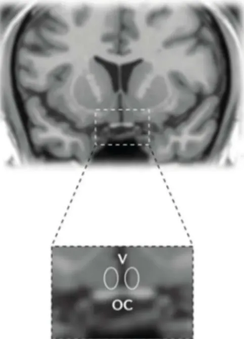 Figure  10 :  Localisation  du  noyau  suprachiasmatique  dans  une  section  coronale  de  cerveau chez l’homme