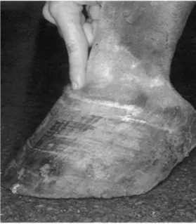 Figure	  14	  :	  Palpation	  de	  la	  dépression	  de	  la	  bande	  coronaire,	  d’après	  Hunt	  et	  Wharton,	  2010	  