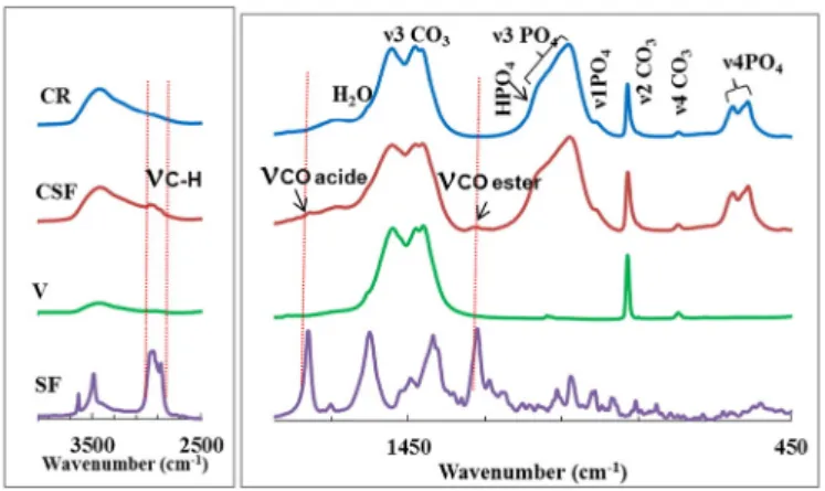 Fig. 3 shows the SEM micrographs of the reactive powders (Fig. 3a and b for brushite and vaterite, respectively) and reference and antibiotic-loaded cements (Fig