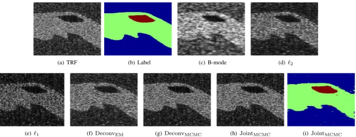 Fig. 8. Group 3: (a) Ground truth of the TRF; (b) Ground truth for label map; (c) Observed B-mode image; (d)-(h) Estimated TRFs in B-mode form obtained with methods  2 ,  1 , Deconv EM , Deconv MCMC and the proposed Joint MCMC ; (i) Estimated label map o