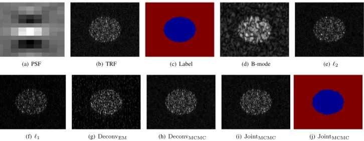 Fig. 6. Group 1: (a) Simulated PSF; (b) Ground truth of the TRF; (c) Ground truth for label map; (d) Observed B-mode image; (e)-(i) Estimated TRFs in B-mode form obtained with methods  2 ,  1 , Deconv EM , Deconv MCMC and the proposed Joint MCMC ; (j) Es