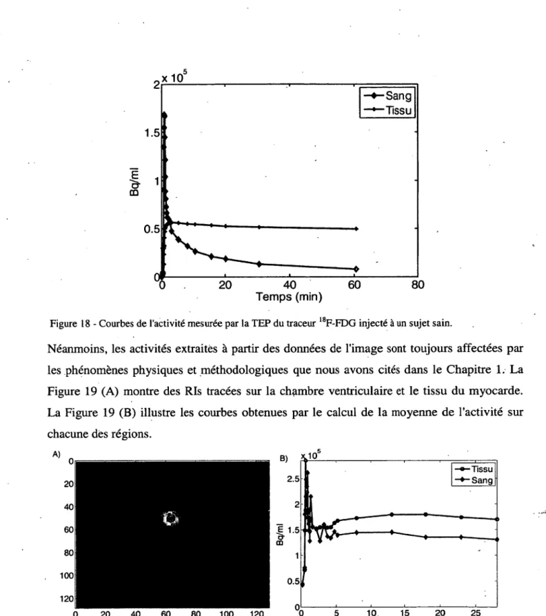 Figure  19 - Activités du traceur extraites  à partir des données de l'image. (A )  les Ris tracées sur l’im ages