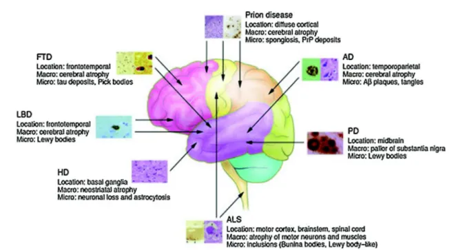 Fig. 1 – Brain anatomical locations of primary macro- and microscopic changes (misfolded proteins) are characteristic of particular neurodegenerative diseases