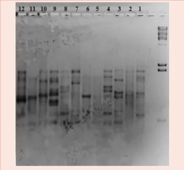 Figure 1: DNA profiles generated by ISSR primer X14 TRAAR (GCC) 4 in 1%   agarose gel of twelve individuals of Artemisia herba alba Asso of Tiaret region  (May 2013).