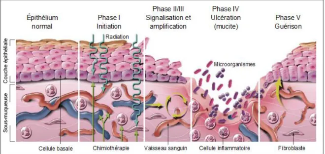 Figure 1. Pathogenèse de la mucite buccale. Image adaptée de Sonis (2004)   [42]