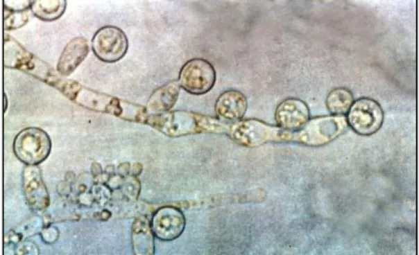Figure 2. Candida albicans. Image de Colm (n.d.)   [61]