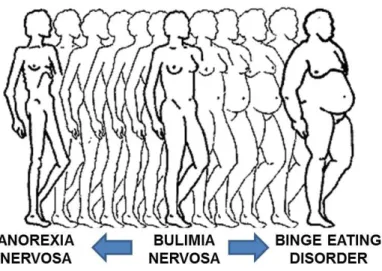 Figure 1. Spectrum of body mass index (BMI) in individuals with eating disorders 