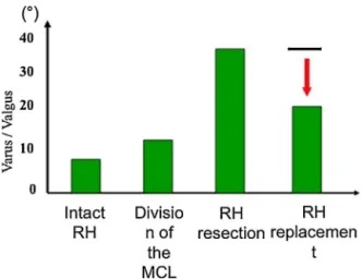 Fig. 4. Evaluation of valgus/varus stability with different procedures. RH: radial head.