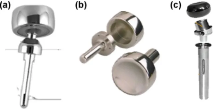 Fig. 12. Detachment of the implant head due to residual postero-lateral elbow instability.