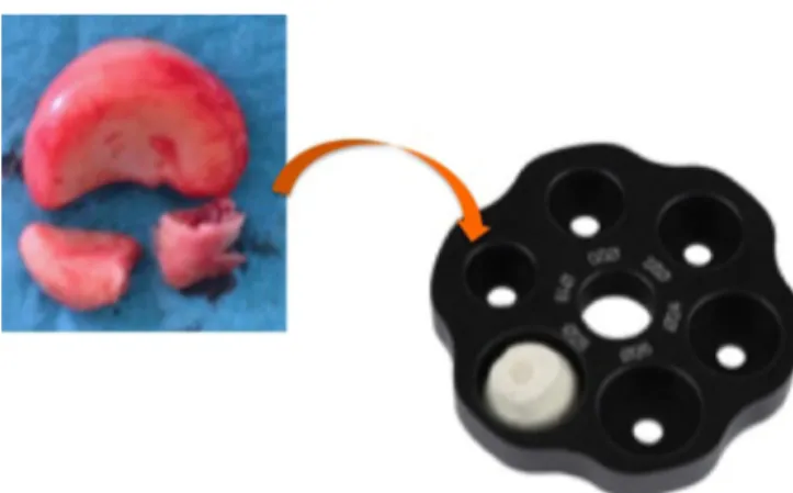 Fig. 14. Implant position criteria determined by intra-operative ﬂuoroscopy. The lateral and medial sides of the humero-ulnar joint space should be symmetrical