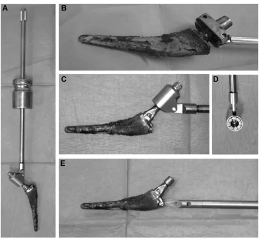 Fig. 2. Stem extraction instruments. Sliding hammer (A) mounted on a vise grip designed to encircle the neck (B) or a ﬂaring system (C and D) or a hook (E) of use for stems with modular necks.