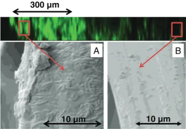 Fig. 4. Sectional views of a carbon felt secondaty bioanode (37 day) observed by epiﬂuorescent microscopy (on top) and SEM of two different ﬁbers (A) on the surface of the carbon felt (B) 1 mm deep in the carbon felt (B).