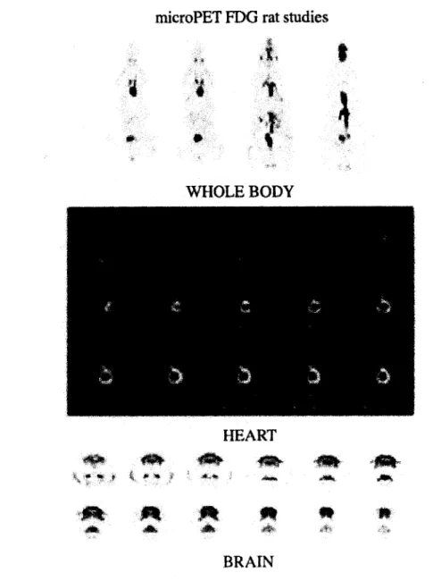 Figure  1.4 : Image du microPET [12]