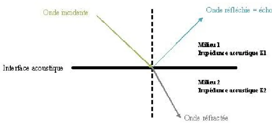 Figure 2: Réflexion et réfraction de l'onde ultrasonore sur l'interface au niveau de deux  milieux d’impédances différentes (Calais E, Dreno C 2004) 