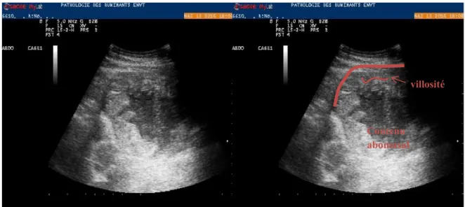Figure 12 : Aspect échographique de la caillette normale et d’une villosité abomasale  (image échographique hôpitaux des Ruminants, ENVT) 