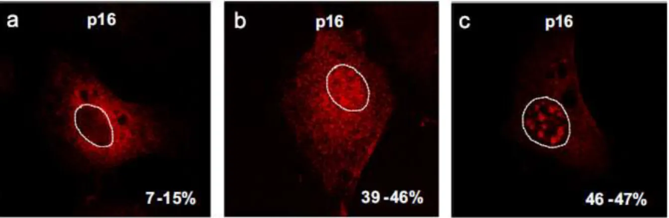 Figure 10 : Distribution cellulaire de la protéine non structurale p16 du RHDV. 