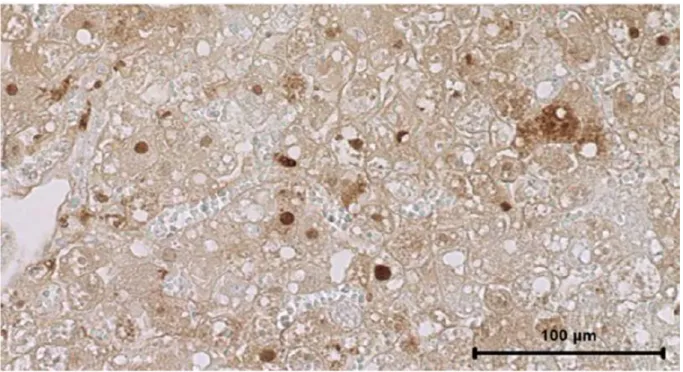Figure 20 : Immunocytochimie évaluant l’apoptose dans le foie.  