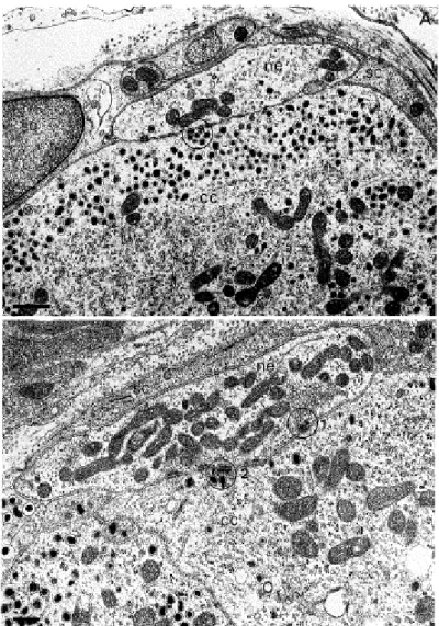 Figure 10 : synapse entre les cellules chémoréceptrices et les terminaisons nerveuses sensorielles
