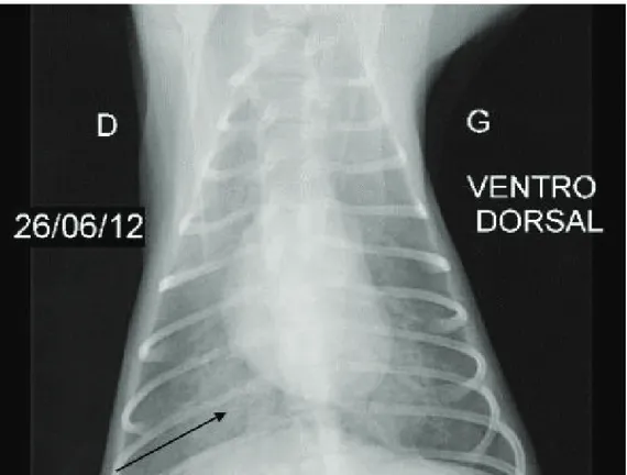 Figure 7 : Radiographie thoracique en vue ventro-dorsale d'un chien atteint de leptospirose aigue :  Pattern broncho-interstitiel caudo-dorsal 