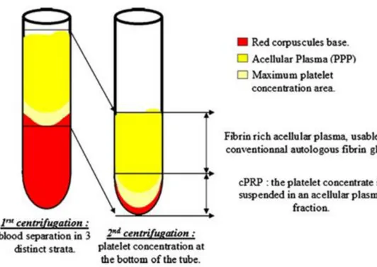 Figure 1 : Concept de formation du Plasma Riche en Plaquette (PRP) d’après Dohan et al