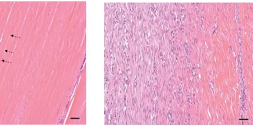 Figure 8 : Coupes histologiques en coloration hématoxyline-éosine de section de tendon sain et  cicatriciel d’après Richarson et al