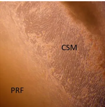 Figure 15: Observation microscopique  directe à J2 (x400, sans coloration) de PRF  mis en culture avec les CSM