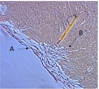 Figure 16: Observation  microscopique d’une coupe 