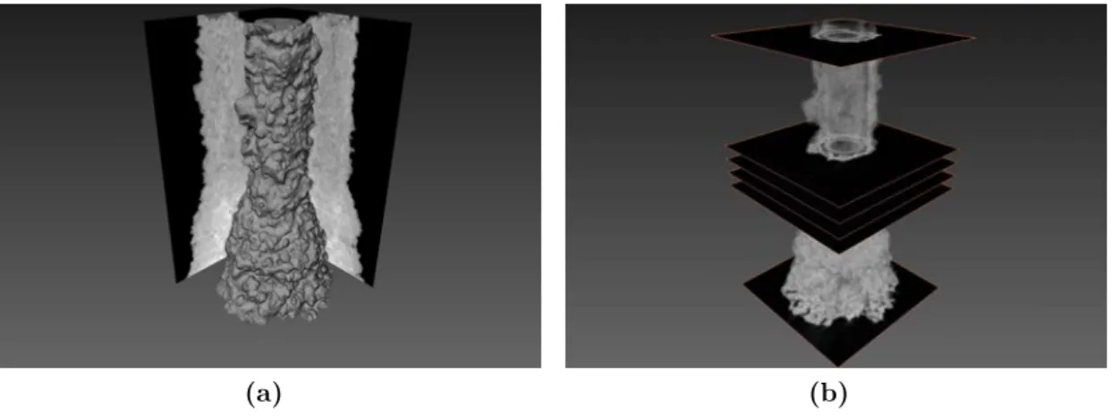 Figure 2.10. – (a) : Rendu volumique d’une image 3D. (b) : À l’aide d’algorithmes de traitement d’images 3D, on peut obtenir des coupes de l’image 3D dans un plan perpendiculaire à l’axe vertical.