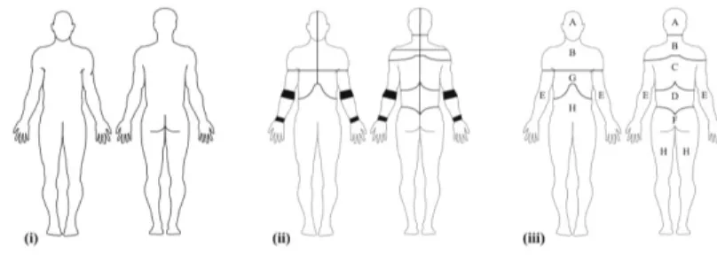 Figure 2. Body diagram (i) presented in the questionnaire   (ii) score template for painful locations [46 locations]  